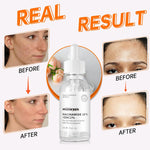 Niacinamide 10% + Zinc 1% Serum, Anti-Aging Niacinamide Serum for Face, 1PCS Moisturizing Facial Serum for All Skin Type, Women Face Skin Care.